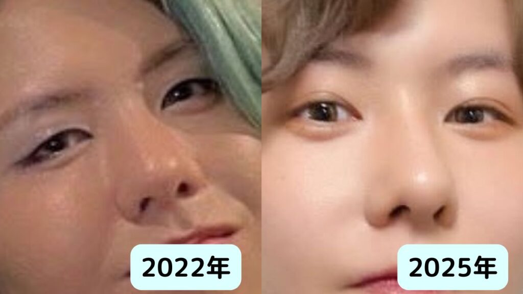 ミセス藤澤涼架は整形？鼻が高い理由と二重幅はいつからか