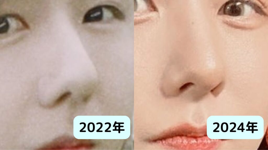 ミセス藤澤涼架は整形？鼻が高い理由と二重幅はいつからか